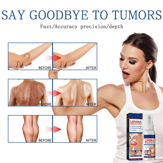 Lipoma Removel Spray