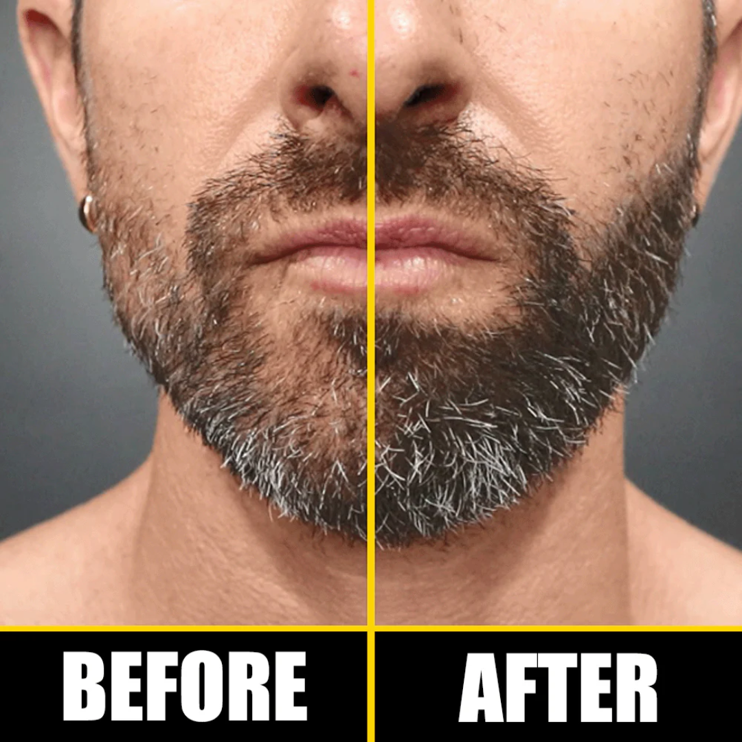 Dr. Alies Professional Beard Growth Oil | Natural Formula with Vitamin E, Almond Oil & Castor Oil