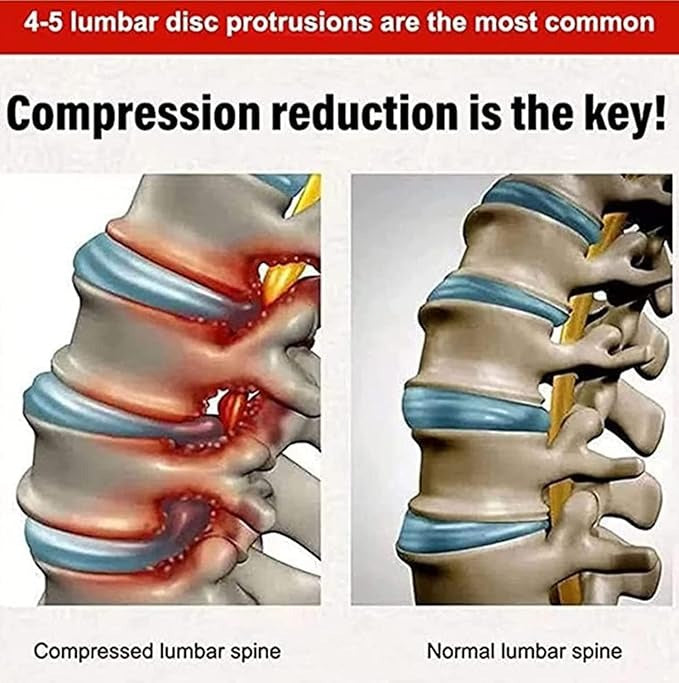 Lumbar Spine Cold Gel Spray for Back and Joint Pain Relief