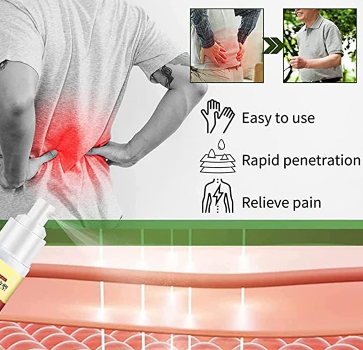 Lumbar Spine Cold Gel Spray for Back and Joint Pain Relief