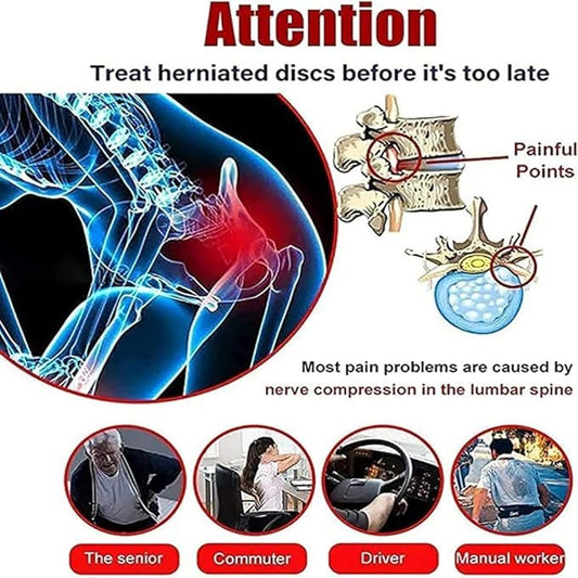 Lumbar Spine Cold Gel Spray for Back and Joint Pain Relief